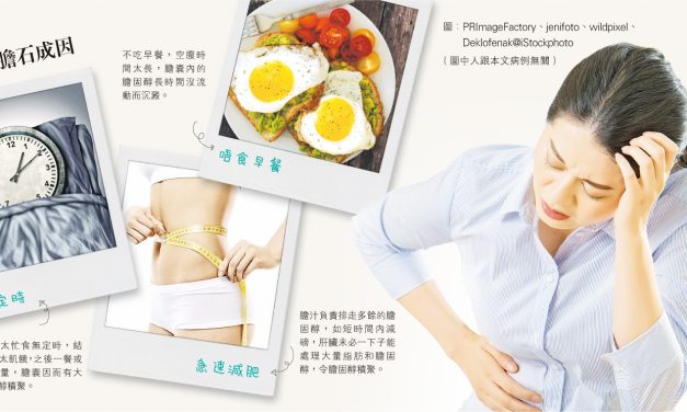 膽囊停工 膽固醇滯留 唔食早餐小心膽生石